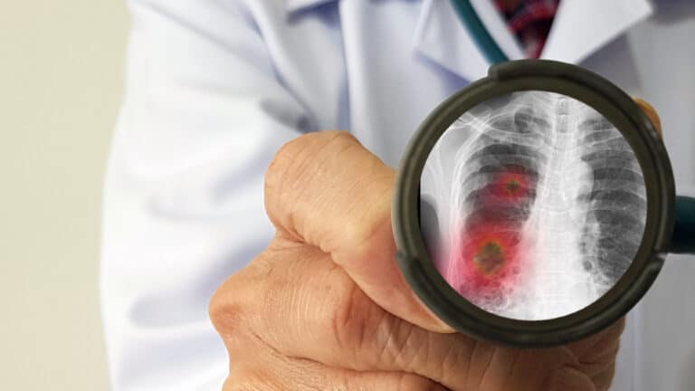Stijging aantal virus-meldingen door nieuwe diagnose